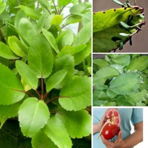 Kalanchoe Pinnata Miracle Leaf Rooted Live Succulent Plant – Bryophyllum Pinnatum - Air Plant Easy Care